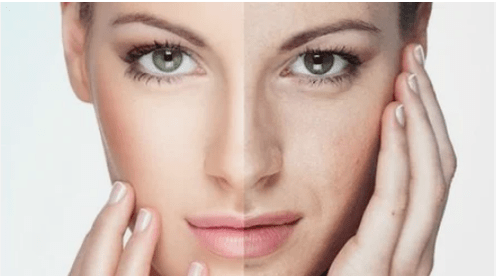 Effective rejuvenation of the face