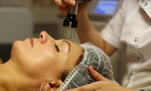 fractional thermolysis for rejuvenation